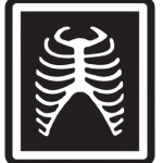 stylish-black-and-white-icon-x-rays-ribs-vector-7142497-removebg-preview